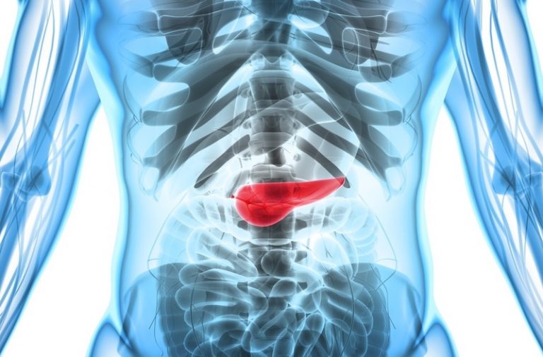 Câncer de pâncreas: estudo traz novidades sobre prevenção para um dos tumores mais agressivos
