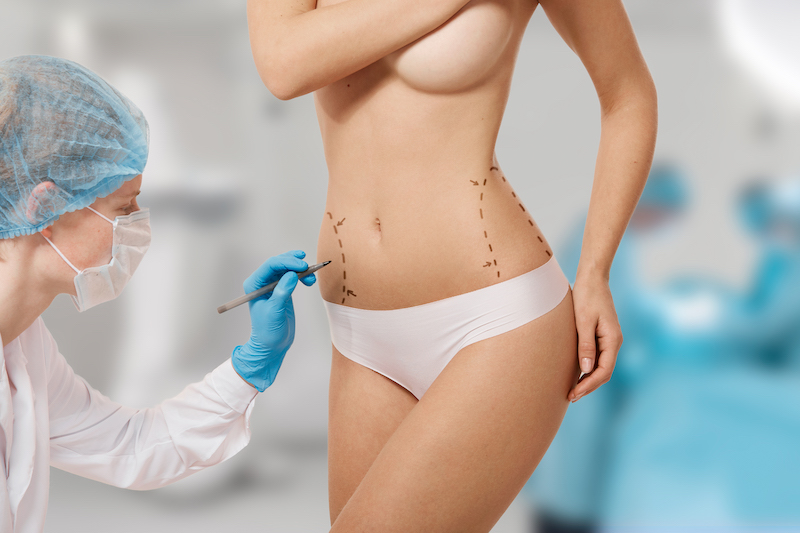 Médico de cirurgia plástica desenha linha na barriga de mulher marcada para cirurgia estética no interior da sala de cirurgia