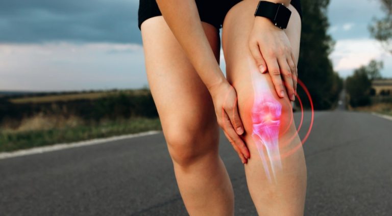 Mitos e verdades sobre artrose