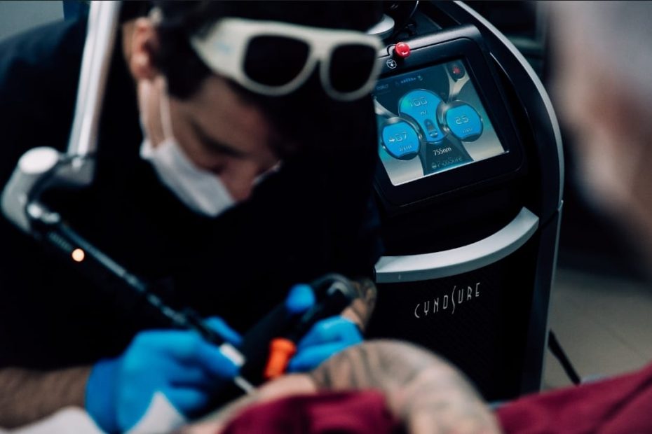 Como o laser atua na remoção de tatuagens?