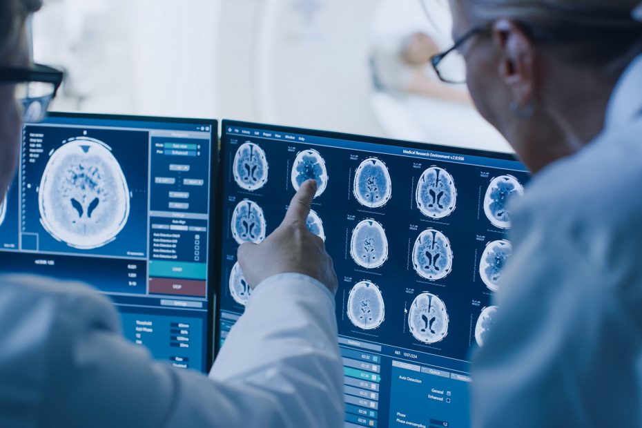 Nova técnica permite diagnosticar Alzheimer com mais precisão
