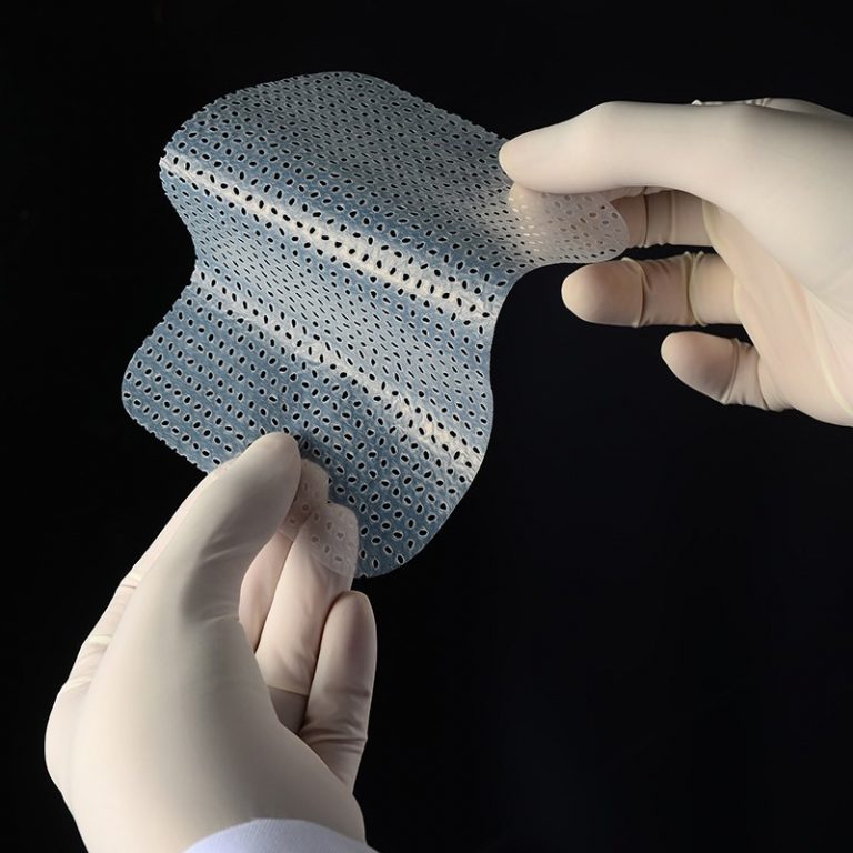 Boate Kiss: membrana que regenera a pele auxiliou vítimas de queimaduras graves