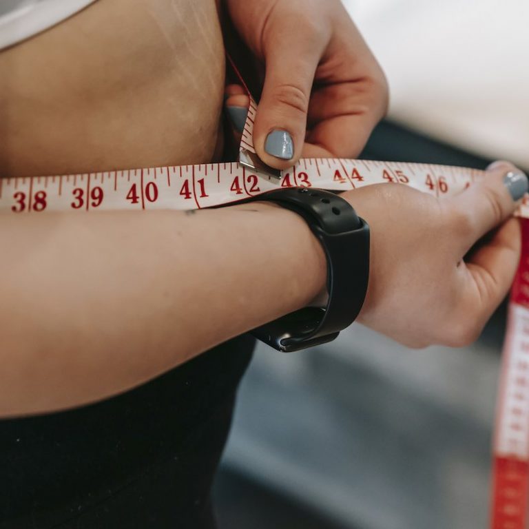 Pacientes bariátricos têm 30% mais risco de desenvolverem osteoporose