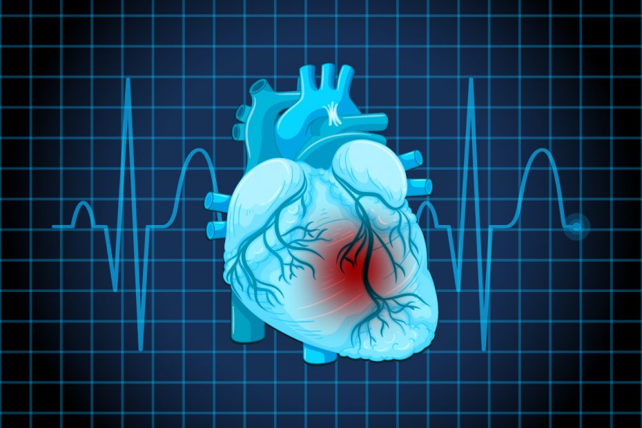 Cardiologista orienta sobre cuidados após o infarto