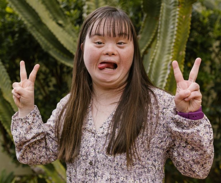 Down é Up – Dia Mundial da Síndrome de Down. Eles podem, eles querem, eles fazem acontecer