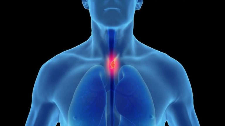 Sem sintomas iniciais, homens estão entre os mais atingidos pelo câncer de esôfago no Brasil