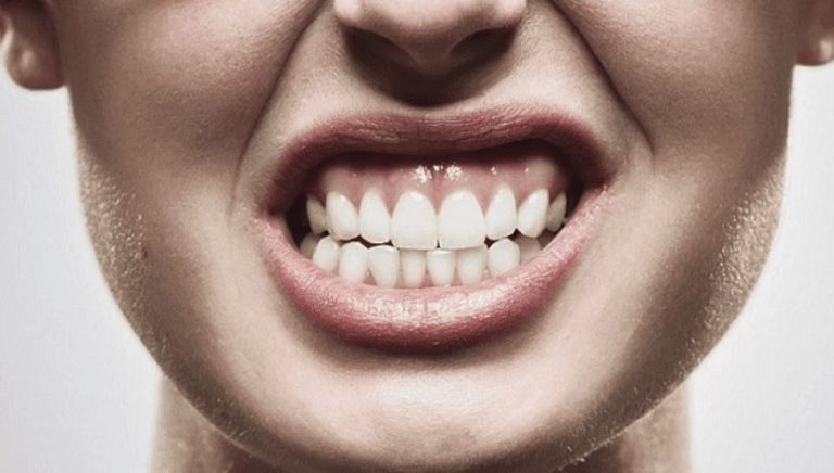 Consequências de não tratar o bruxismo: Descubra os sintomas e tratamentos