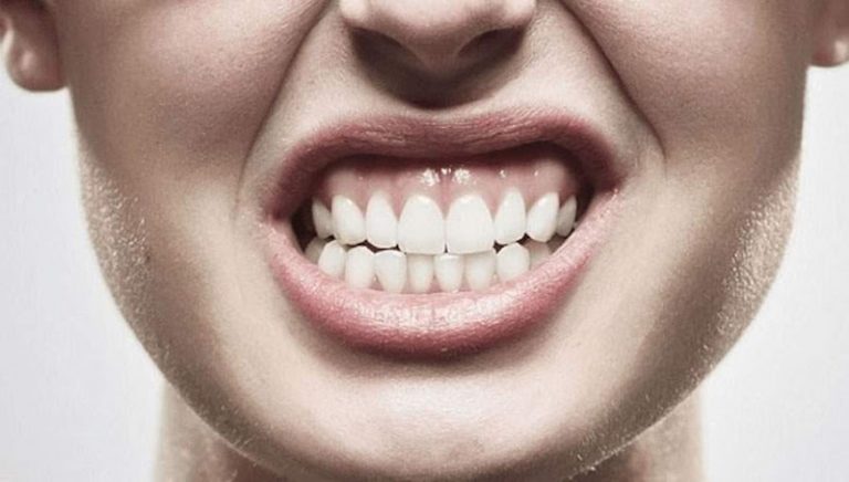 Afta de longa duração pode ser um sinal de alerta para câncer oral, desmistifica a Dra. Bruna Conde, especialista em Odontologia