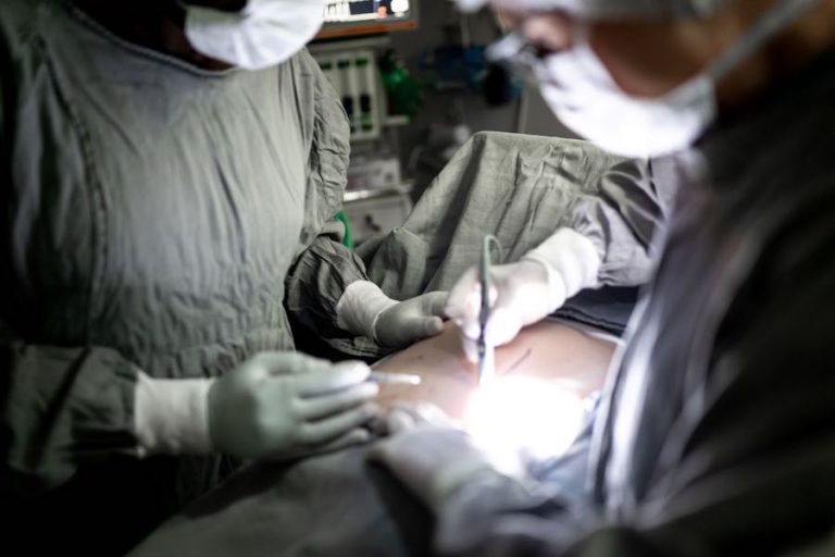 Lipoaspiração: O que esperar desta cirurgia no homem