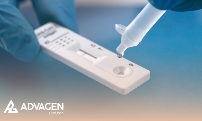 Exames feitos em farmácias vão agilizar o diagnóstico rápido de doenças no Brasil