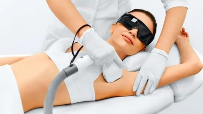 Depilação a laser: tecnologia que permite sessões durante o verão, em todos os tipos de pele