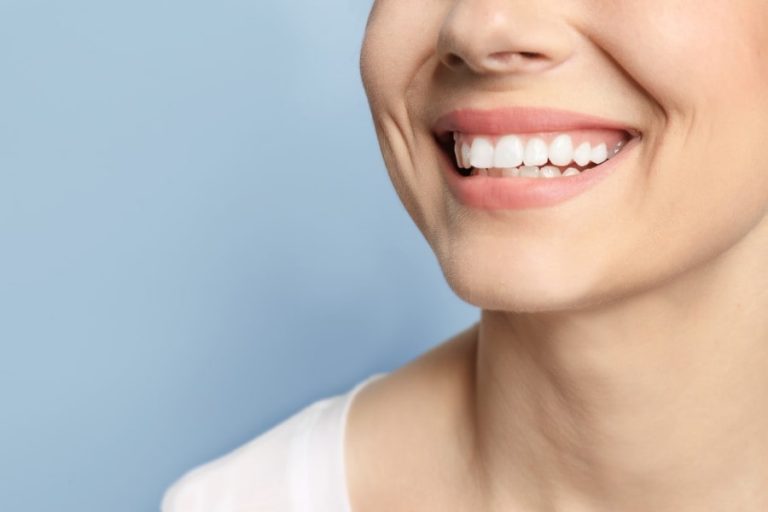 5 vantagens para trocar a dentadura por um implante dentário