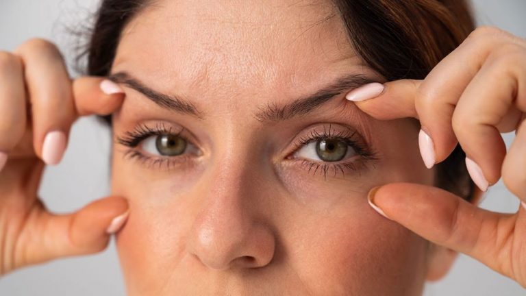 Descubra Como Remover Rugas e Flacidez das Pálpebras sem Cirurgia: Conheça Técnicas da Blefaroplastia sem Cortes