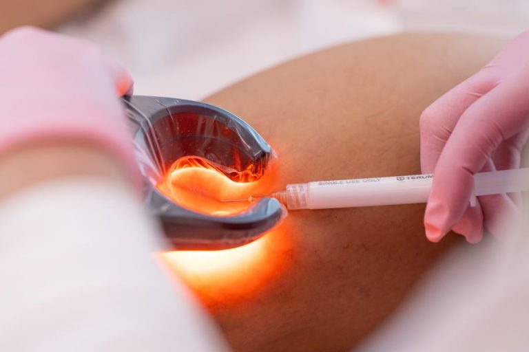 Saiba quais são os cuidados vasculares essenciais antes de realizar procedimentos cirúrgicos