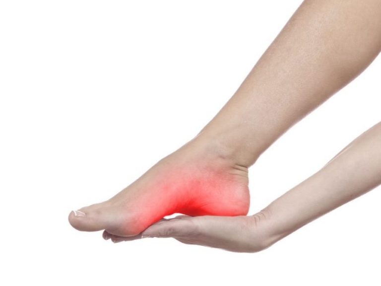 Fascite Plantar: Um Desafio Crescente e Como as Palmilhas Sob Medida Podem Oferecer Alívio