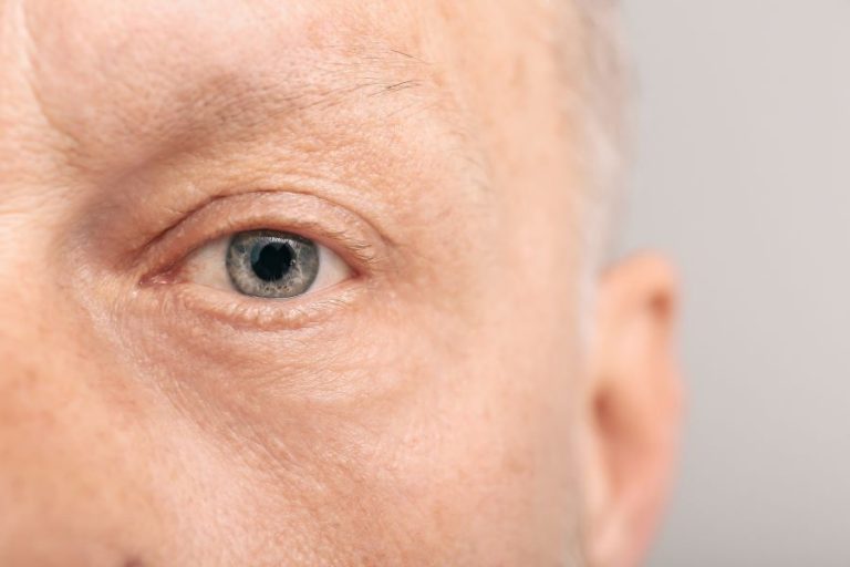 Transplante de supercílios: técnica eficaz para recuperar sua expressão facial