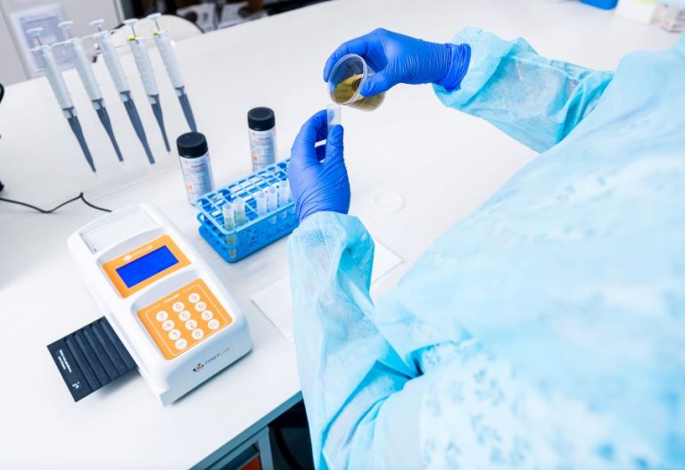 Urina escura pode indicar problemas graves nos rins