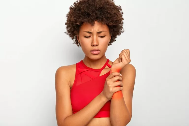 Pó de Café, pasta de dente e manteiga? Nada disso funciona! Saiba o que fazer em caso de queimaduras