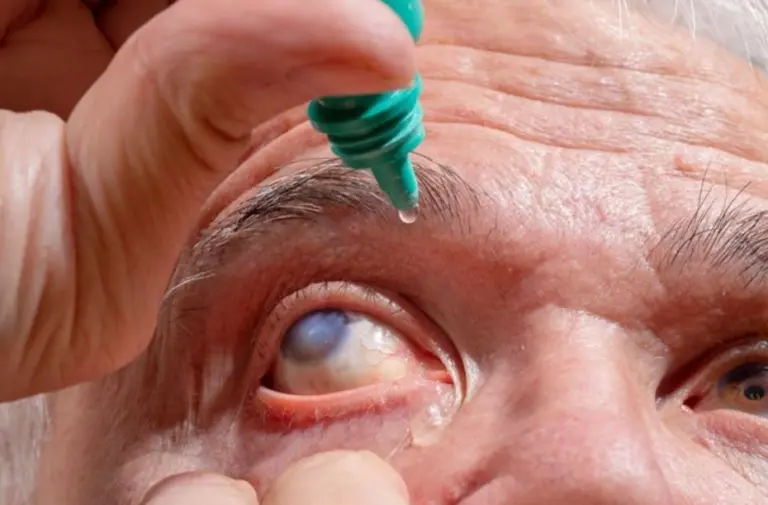 Novo tratamento pode reduzir cegueira por catarata
