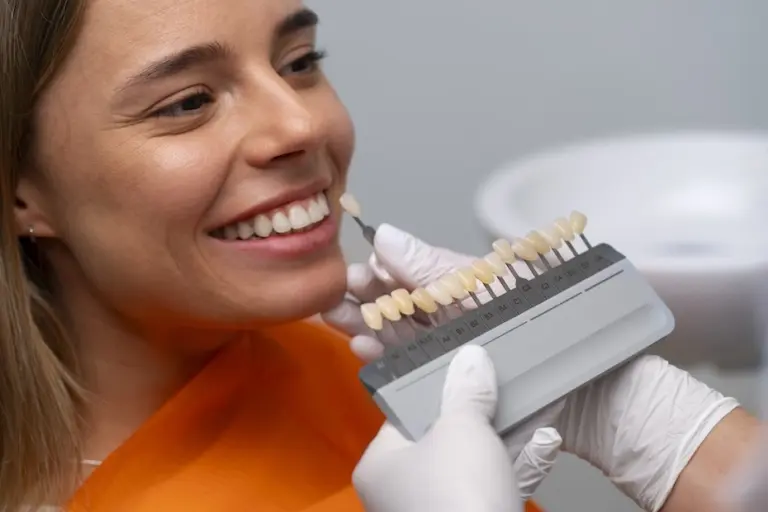 Mitos e verdades sobre lente de contato dental: o procedimento queridinho dos famosos