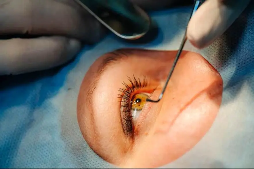 Cirurgia de catarata: Saiba como ter conforto na frente das telas