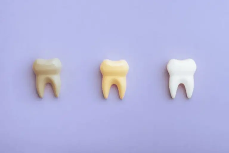 Mitos e verdades sobre alimentos que mancham os dentes