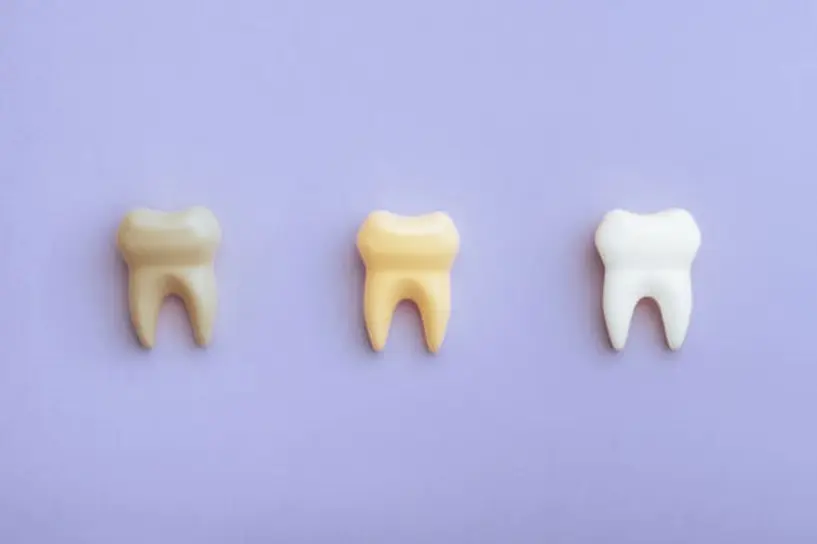 Mitos e verdades sobre alimentos que mancham os dentes