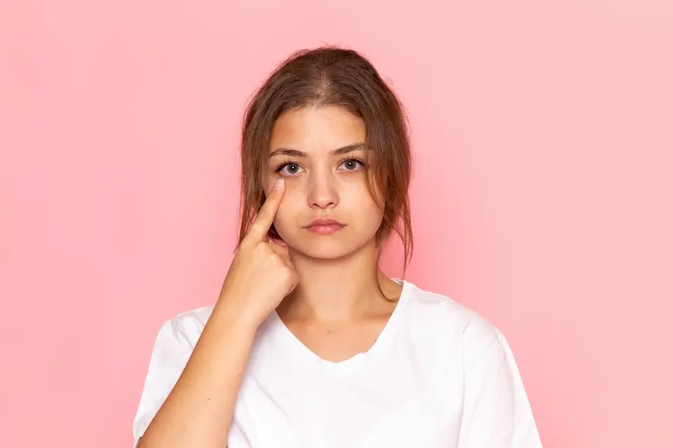 Olheiras: genética, cansaço ou estilo de vida? Saiba o que realmente causa o problema