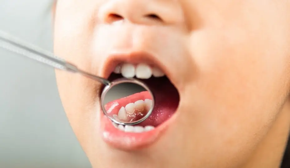 Saúde bucal infantil: 5 dicas para começar os cuidados desde cedo