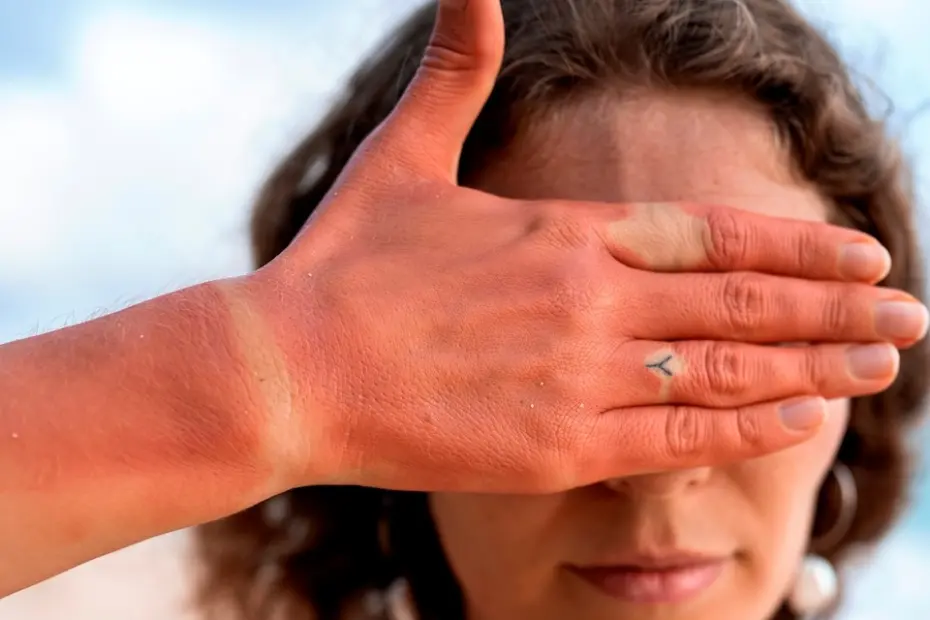 Radiação do aquecimento causa até 20% da catarata estima OMS