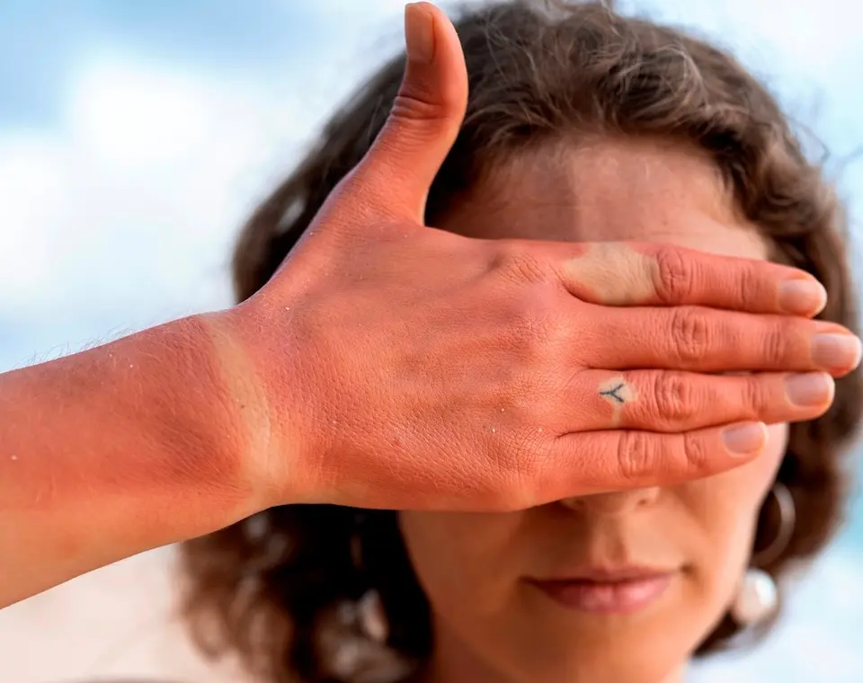 Radiação do aquecimento causa até 20% da catarata estima OMS