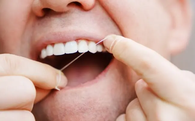 Você sabe usar o fio dental do jeito certo? 4 erros e como evitá-los