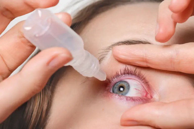 5 dicas para prevenir alergias oculares, entre elas evitar coçar os olhos