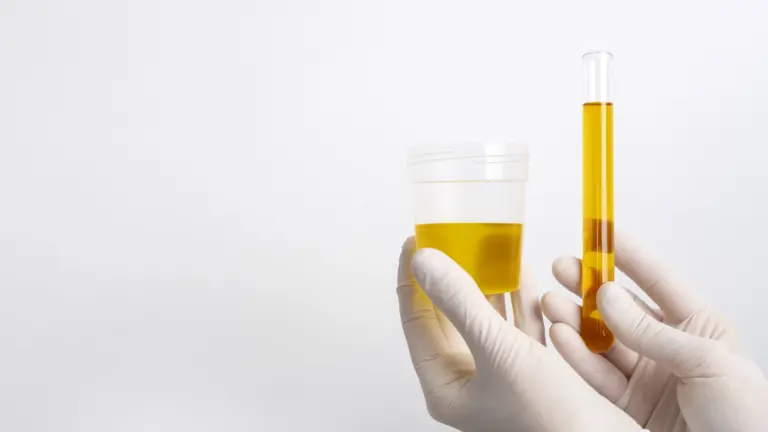 Conheça as diferentes formas da infecção urinária e os erros do dia a dia que as alimentam