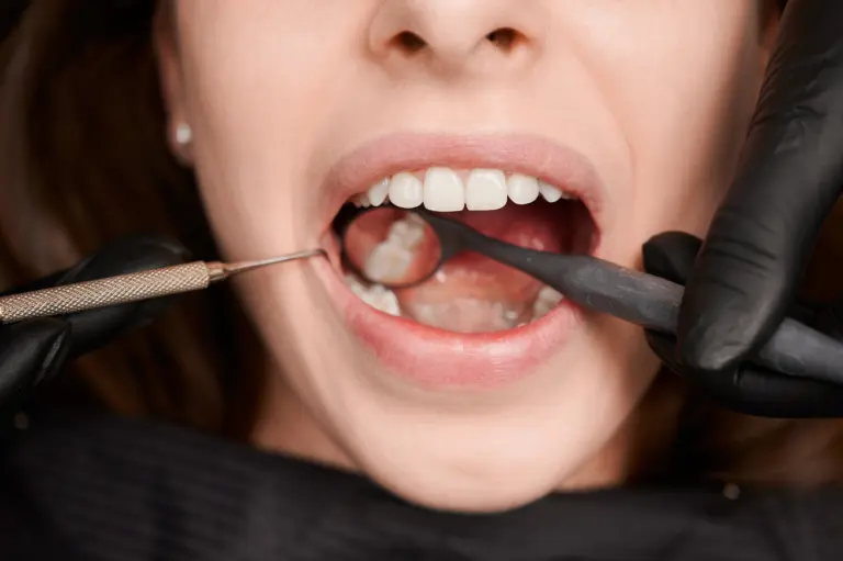 Siso: extrair ou não? Especialistas explicam quando a cirurgia é realmente necessária