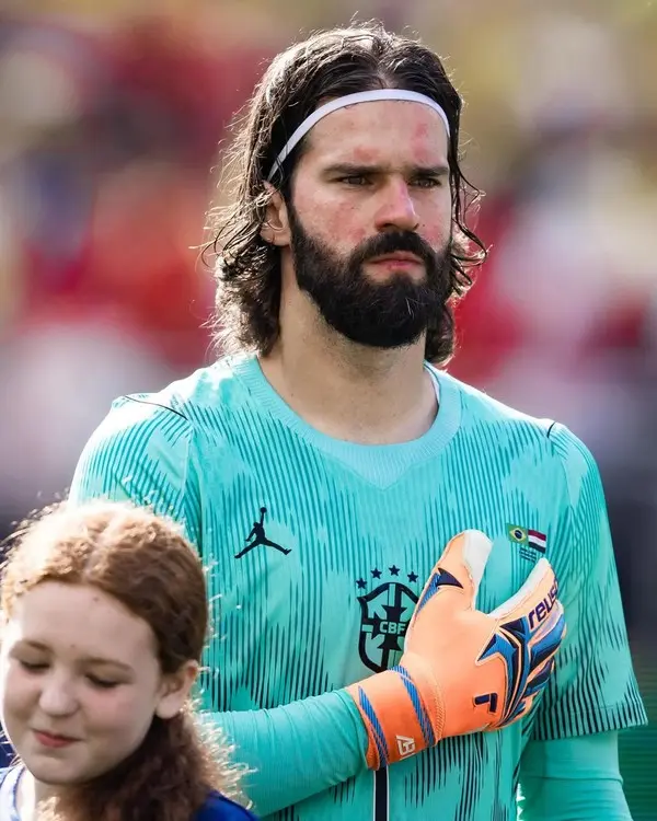 Vermelhidão no rosto do goleiro Alisson Becker volta a chamar atenção; entenda a causa