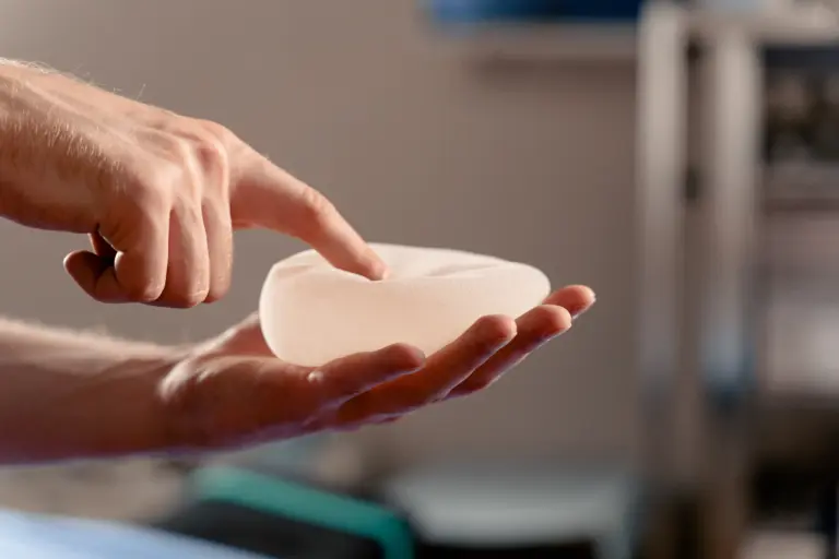 Posicionamento de implantes representa benefícios e riscos importantes na reconstrução mamária