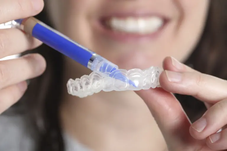 Clareamento dental: riscos das receitas caseiras e cuidados