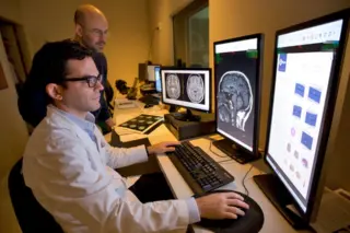 Especialistas analisam exames de ressonância magnética cerebral com auxílio de sistemas de Inteligência Artificial capazes de medir estruturas ligadas à memória.