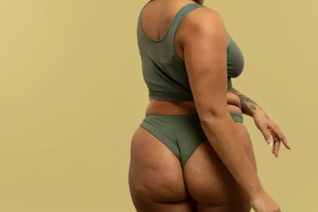Tronco e parte inferior do corpo de mulher com top e calcinha verdes, mostrando ondulações de pele (celulite) nos glúteos e coxas, fundo bege